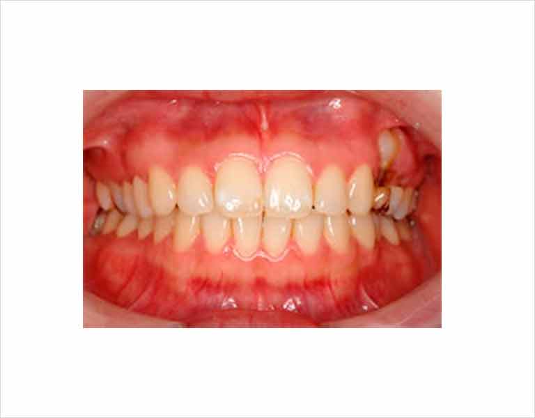 口腔内規格・写真の撮影