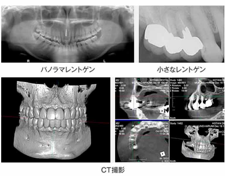 レントゲン・写真撮影