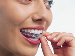 マウスピース矯正