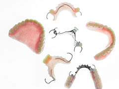 周りの歯の負担を軽減。また、周りの歯を削らない