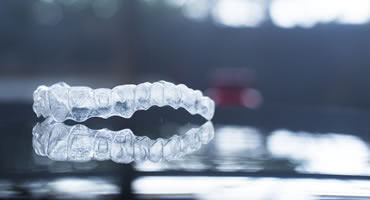 お悩み別に審美歯科の治療法を具体的に説明しちゃいます！