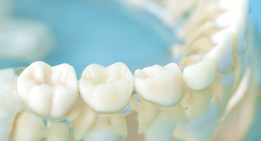 オールオン4にする箇所はどこでも良いの？