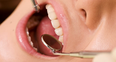 オールオン４を快適に長持ちさせる為の定期検診