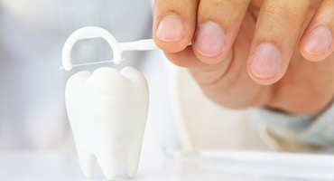 インプラント中の人は歯周病ケアを丁寧に