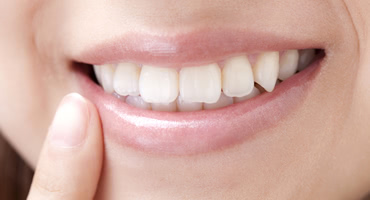 健康な歯でいたいから！「歯周ポケット2ミリ」以内を目指そう！