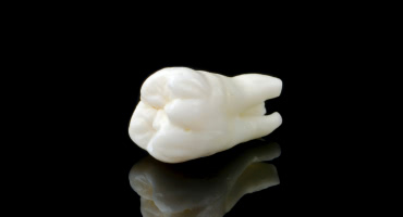 歯が抜け落ちてしまった