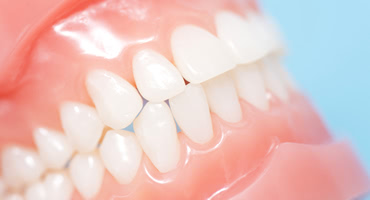 本当に一生もの？セラミック製の歯の寿命は？