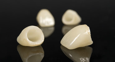 ほかの歯の寿命