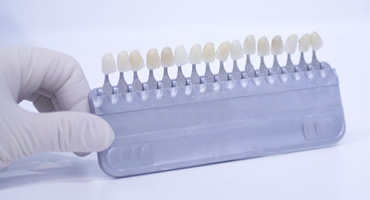 そもそもセラミック歯とは