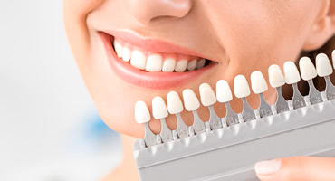 ホワイトニングをしたら口臭は減るの？