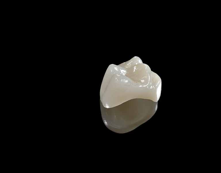 セラミック治療