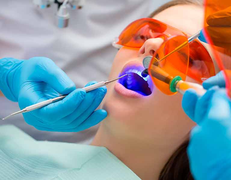 オフィスホワイトニング