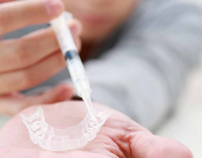 ホームホワイトニング