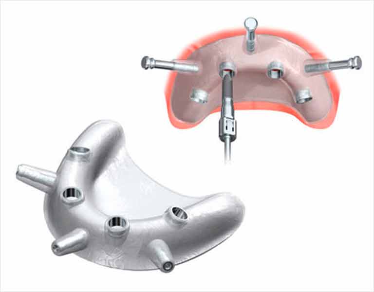 ノーベルガイド