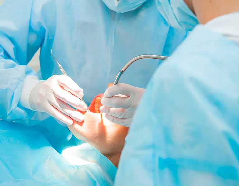 手術時の安全性