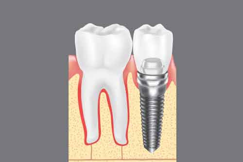 メインテナンス