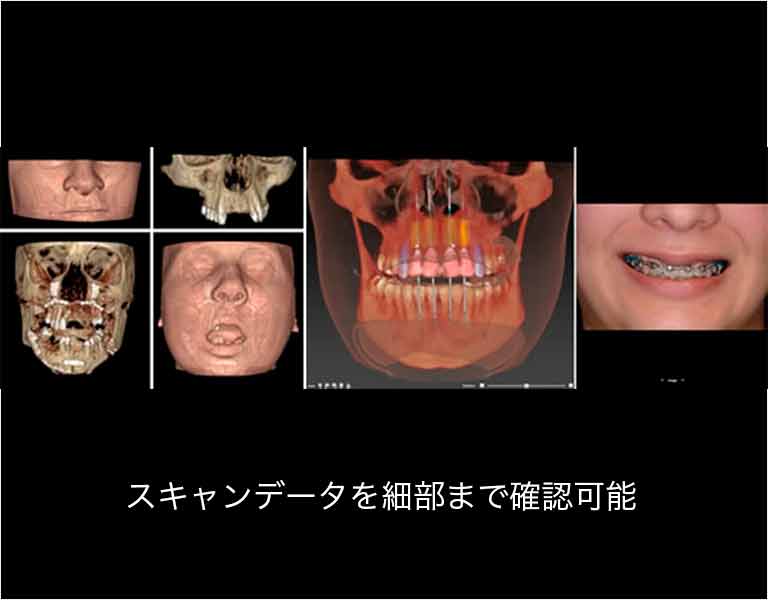 スキャンデータを細部まで確認可能