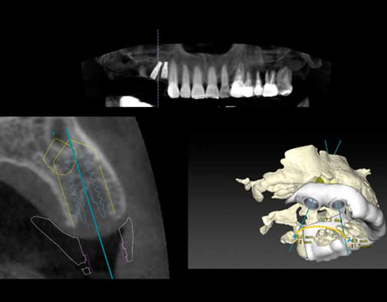 ノーベルガイドシステム