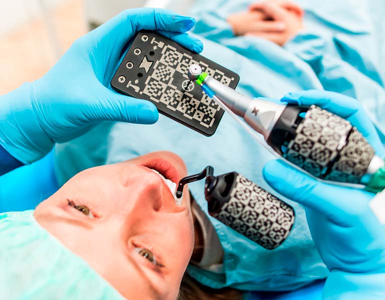 これまでにない安全・確実・快適なインプラント手術 X-ガイド