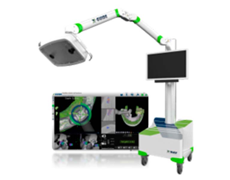 リアルタイムなナビゲーションにより手術を確実に成功に導く