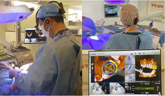 歯科用CTによる精密な診断