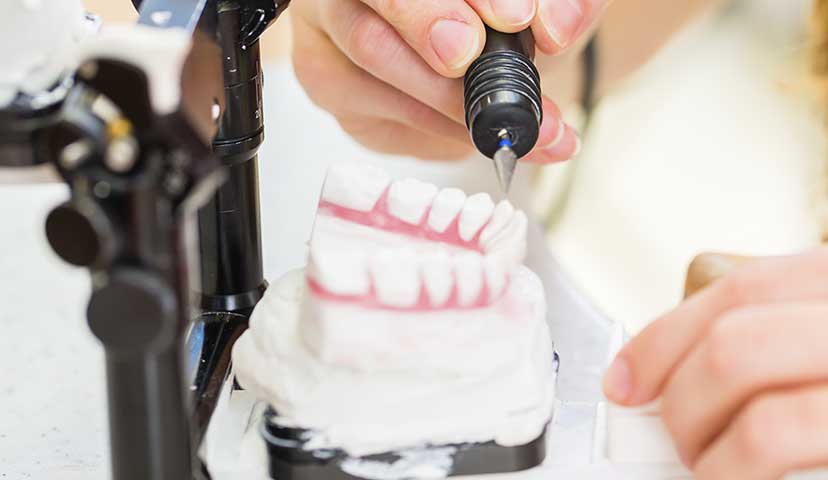 院内技工所完備で素早い対応が可能 早く美しい仕上がり