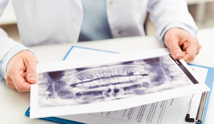 豊富なインプラント症例数と実績