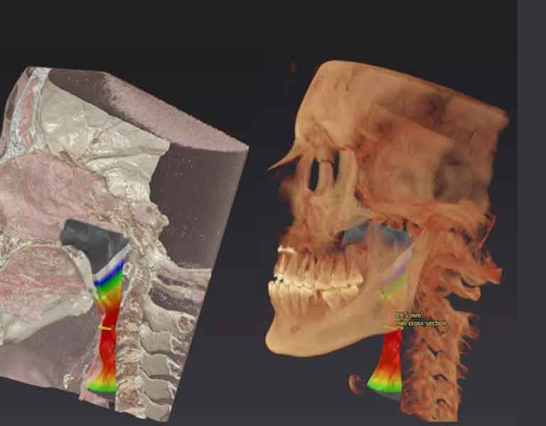 患者様と丁寧なカウンセリング