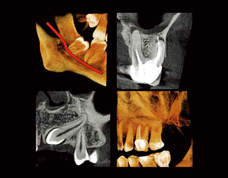 様々な場面での高解像度スキャンを実現