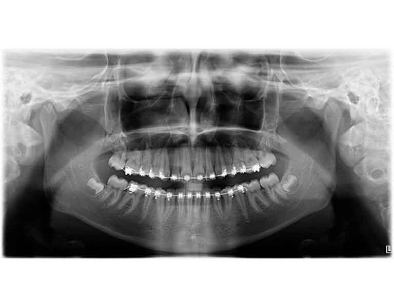 撮影時間が短い