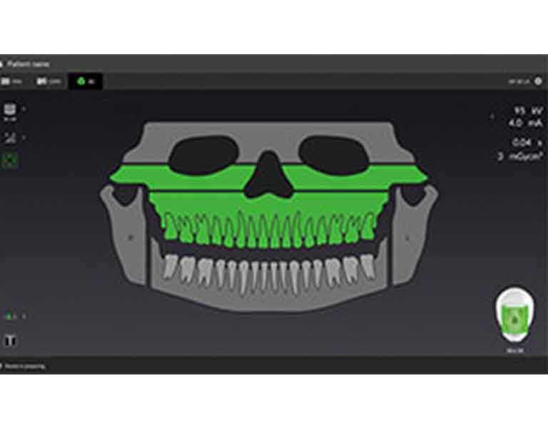 最適なポジショニングが可能