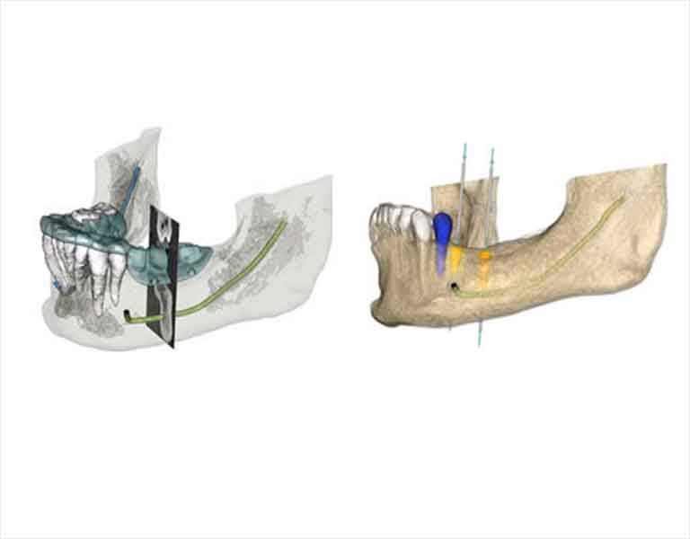 インプラント治療の特徴一覧