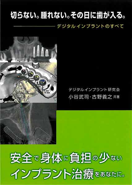 デジタルインプラント研究会
