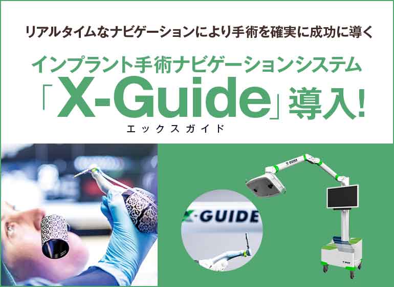 インプラント手術ナビゲーションシステムX-ガイド